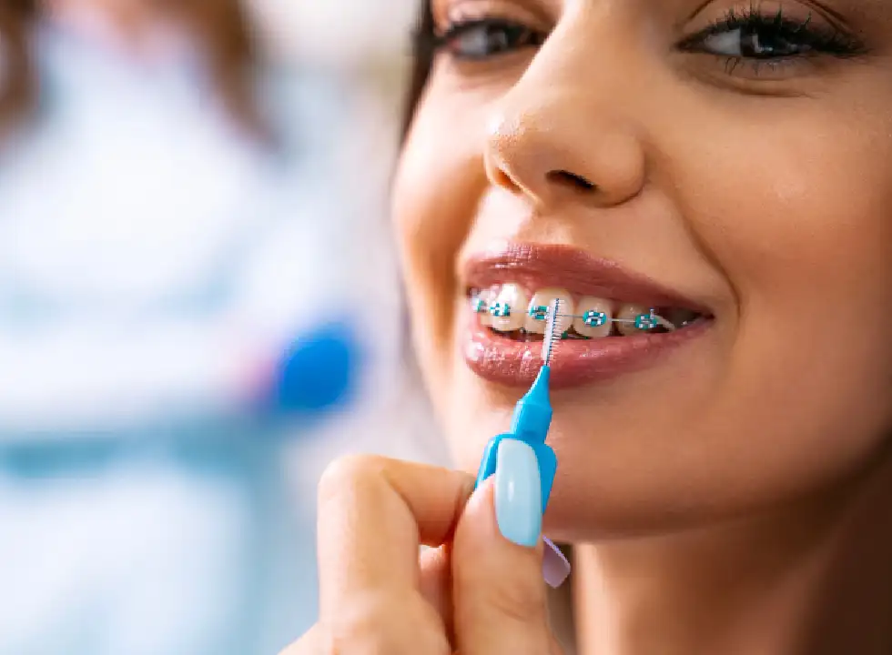 Dental Braces Techniques For Minimal Discomfort